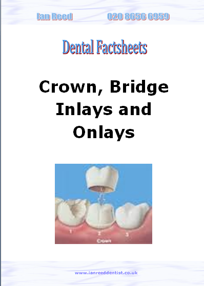 Crown, Bridge, Inlays and onlays factsheet