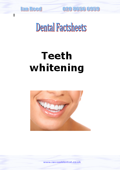 Teeth whitening factsheet